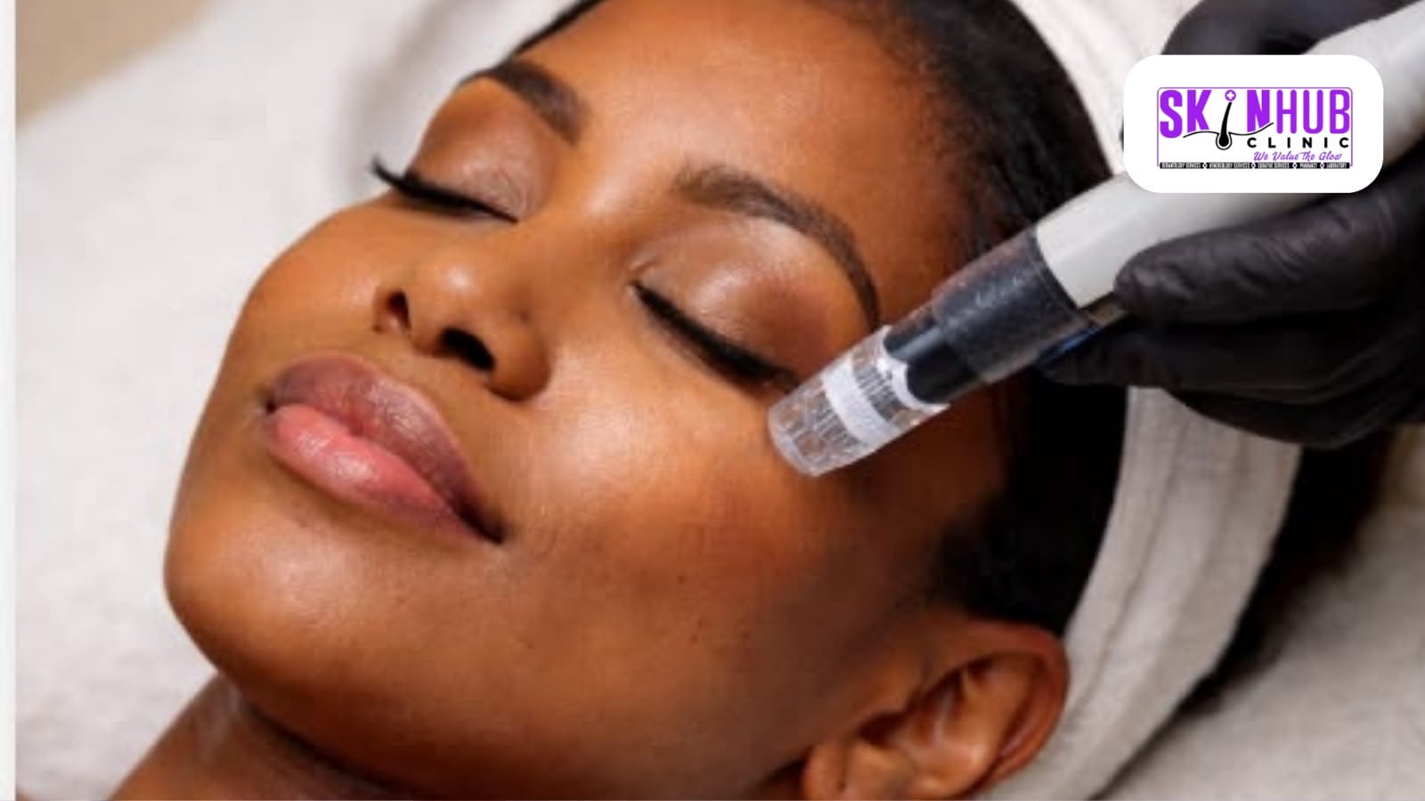 A microneedling pen being passed over a patient’s cheek during a collagen induction session